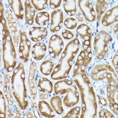 Immunohistochemistry-Paraffin: eEF1A1 Antibody - Azide and BSA Free [NBP2-92880]