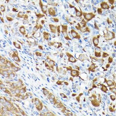 Immunohistochemistry-Paraffin: eEF1A1 Antibody - Azide and BSA Free [NBP2-92880]