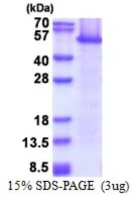 SDS-PAGE: Recombinant Human eEF1A1 Protein [NBP2-51626]