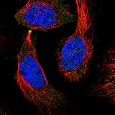 Immunocytochemistry/ Immunofluorescence: eEF1A2 binding protein Antibody [NBP2-48962]