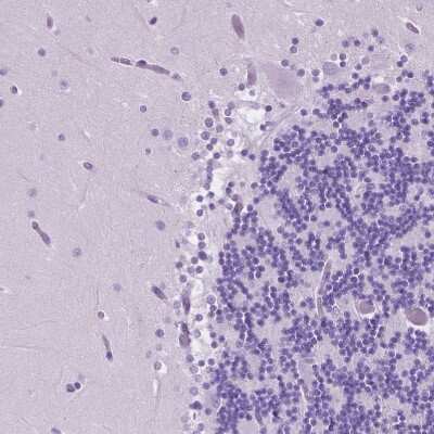 Immunohistochemistry-Paraffin: eEF1A2 binding protein Antibody [NBP2-48962]