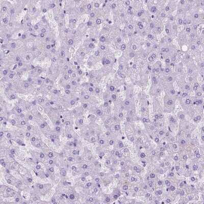 Immunohistochemistry-Paraffin: eEF1A2 binding protein Antibody [NBP2-48962]
