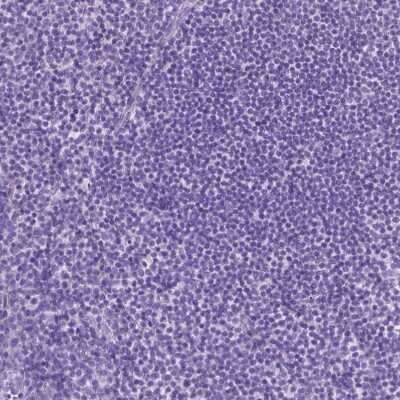 Immunohistochemistry-Paraffin: eEF1A2 binding protein Antibody [NBP2-48962]