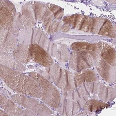 Immunohistochemistry-Paraffin: eEF1A2 binding protein Antibody [NBP2-48962]