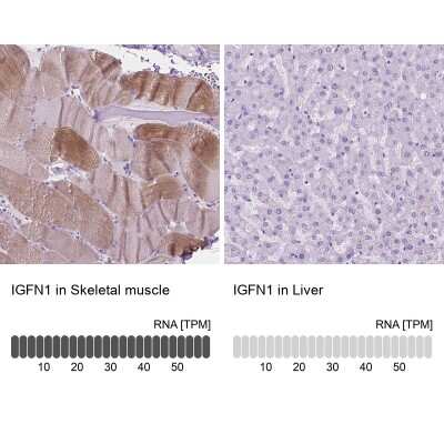 Immunohistochemistry-Paraffin: eEF1A2 binding protein Antibody [NBP2-48962]
