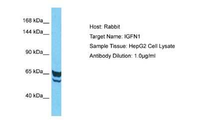 Western Blot: eEF1A2 binding protein Antibody [NBP2-87329]