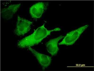 Immunocytochemistry/ Immunofluorescence: eIF2 alpha/EIF2S1 Antibody (3H12-C11) [H00001965-M01]