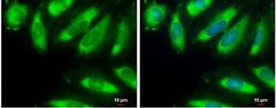 Immunocytochemistry/ Immunofluorescence: eIF2 alpha/EIF2S1 Antibody [NBP1-32289]
