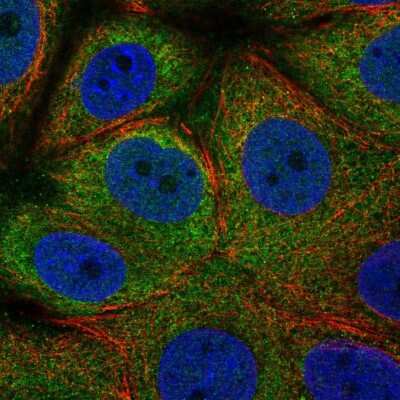 Immunocytochemistry/ Immunofluorescence: eIF2 alpha/EIF2S1 Antibody [NBP2-49428]