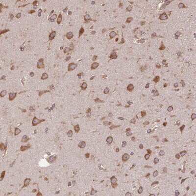 Immunohistochemistry-Paraffin: eIF2 alpha/EIF2S1 Antibody [NBP2-49428]