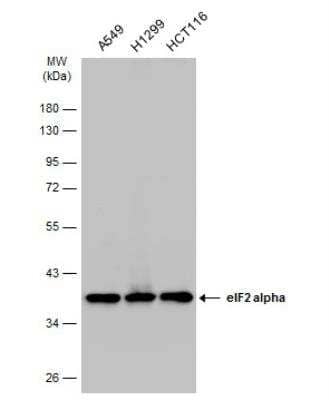 Western Blot: eIF2 alpha/EIF2S1 Antibody [NBP1-32289]