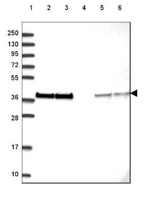 Western Blot: eIF2 alpha/EIF2S1 Antibody [NBP2-49428]