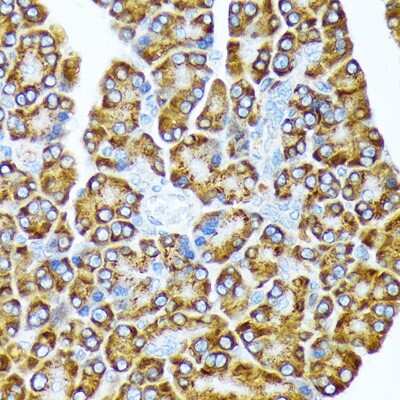 Immunohistochemistry-Paraffin: eIF2A Antibody (8V8H7) [NBP3-16864]