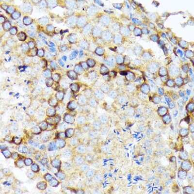 Immunohistochemistry-Paraffin: eIF2A Antibody (8V8H7) [NBP3-16864]