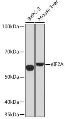 Western Blot: eIF2A Antibody (8V8H7) [NBP3-16864]