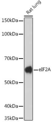 Western Blot: eIF2A Antibody (8V8H7) [NBP3-16864]
