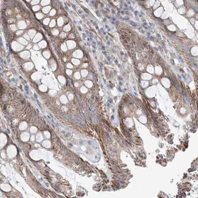 Immunohistochemistry-Paraffin: eIF2A Antibody [NBP1-84879]