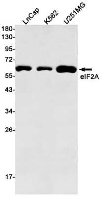 Western Blot: eIF2A Antibody (S08-8E2) [NBP3-14927]