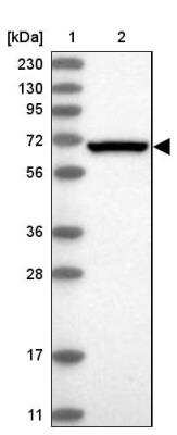 Western Blot: eIF2A Antibody [NBP1-84879]