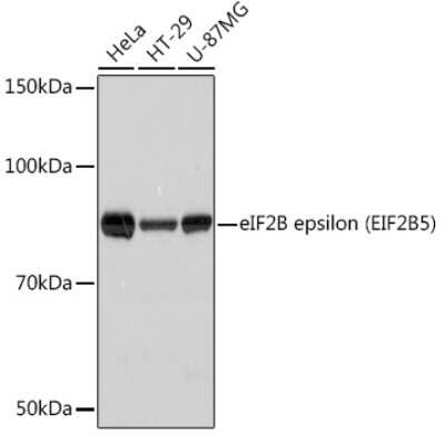 Western Blot: eIF2B epsilon Antibody (5M2D4) [NBP3-16674]