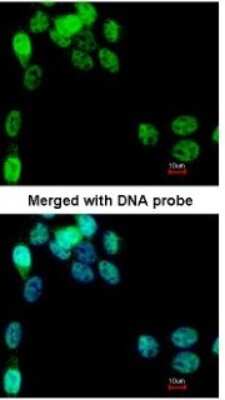 Immunocytochemistry/ Immunofluorescence: eIF2B epsilon Antibody [NBP1-32783]