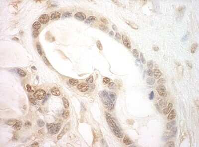 Immunohistochemistry: eIF2B epsilon Antibody [NBP1-30448]