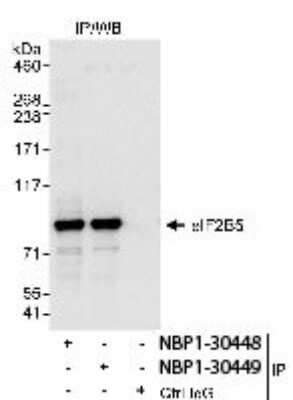Immunoprecipitation: eIF2B epsilon Antibody [NBP1-30449]