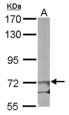 Western Blot: eIF2B epsilon Antibody [NBP1-32783]
