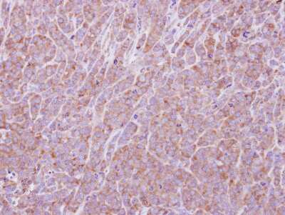 Immunohistochemistry-Paraffin: eIF2B1 Antibody [NBP2-16292]