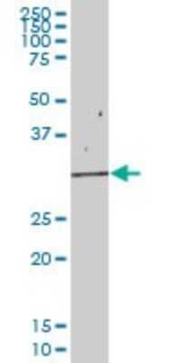 Western Blot: eIF2B1 Antibody [H00001967-B01P]