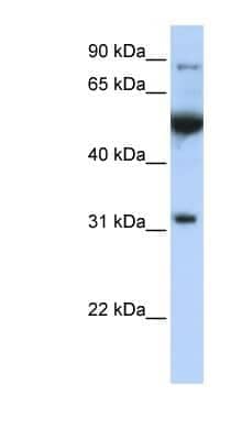 Western Blot: eIF2B1 Antibody [NBP1-57644]