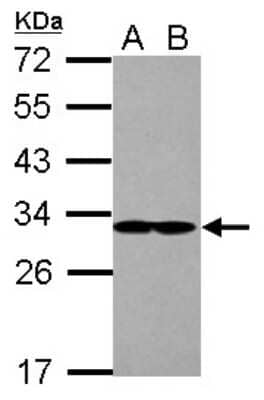 Western Blot: eIF2B1 Antibody [NBP2-16292]