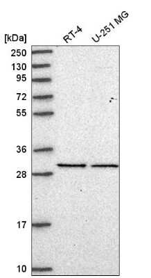 Western Blot: eIF2B1 Antibody [NBP2-58544]