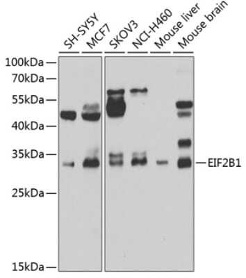 Western Blot: eIF2B1 AntibodyBSA Free [NBP3-04659]