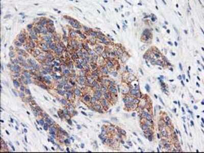 Immunohistochemistry-Paraffin: eIF2B3 Antibody (OTI1A4) [NBP2-01370]