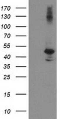 Western Blot: eIF2B3 Antibody (OTI1A4) [NBP2-01370]