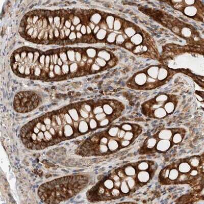 Immunohistochemistry-Paraffin: eIF2B3 Antibody [NBP1-83985]