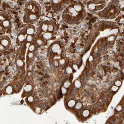 Immunohistochemistry-Paraffin: eIF2B3 Antibody [NBP1-83986]