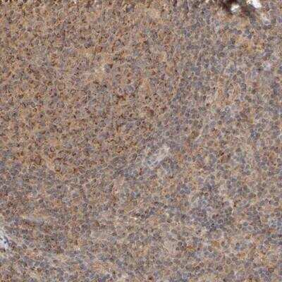 Immunohistochemistry-Paraffin: eIF2B3 Antibody [NBP1-83987]