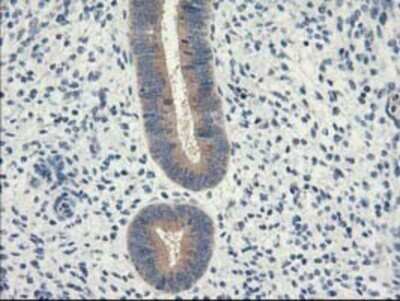 Immunohistochemistry: eIF2B3 Antibody (OTI1A4) - Azide and BSA Free [NBP2-71397]