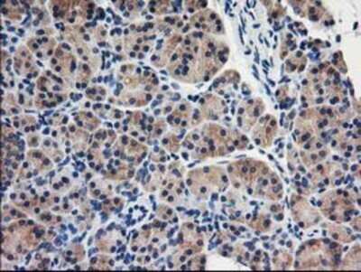 Immunohistochemistry: eIF2B3 Antibody (OTI1A4) - Azide and BSA Free [NBP2-71397]