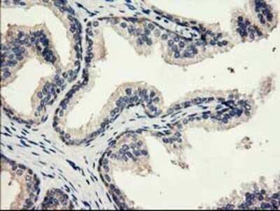 Immunohistochemistry: eIF2B3 Antibody (OTI1A4) - Azide and BSA Free [NBP2-71397]