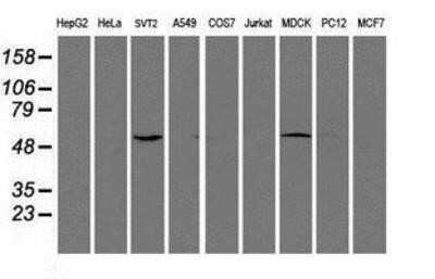 Western Blot: eIF2B3 Antibody (OTI1A4)Azide and BSA Free [NBP2-71397]
