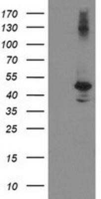 Western Blot: eIF2B3 Antibody (OTI1A4)Azide and BSA Free [NBP2-71397]