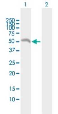 Western Blot: eIF2B3 Antibody [H00008891-B01P]