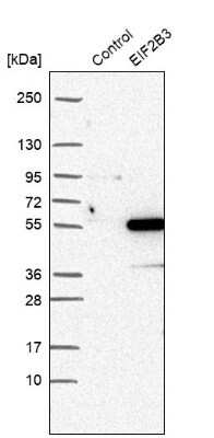 Western Blot: eIF2B3 Antibody [NBP1-83986]