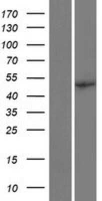 Western Blot: eIF2B3 Overexpression Lysate [NBP2-10252]