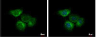 Immunocytochemistry/ Immunofluorescence: eIF2B4 Antibody [NBP2-16293]