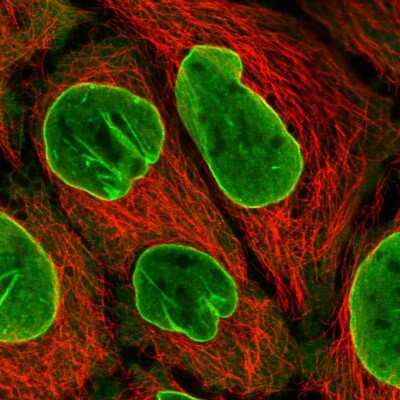 Immunocytochemistry/ Immunofluorescence: eIF2B4 Antibody [NBP2-58603]