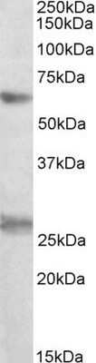 Western Blot: eIF2B4 Antibody [NBP1-49848]